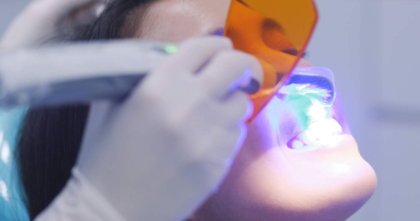 UniFacens e FGM Dental Group realizam curso prático sobre clareamento dental